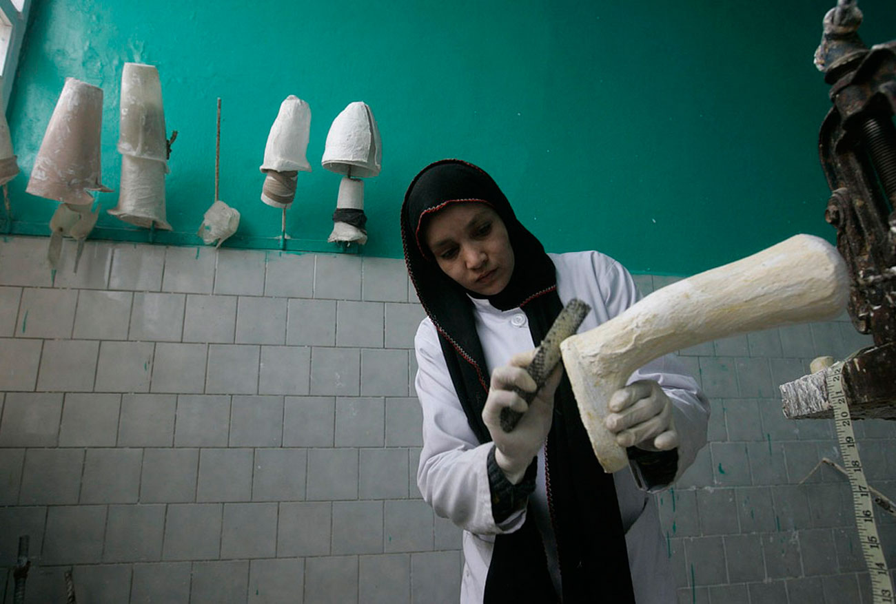 протезы конечностей в Кабульской Ортопедической организации, фото войны