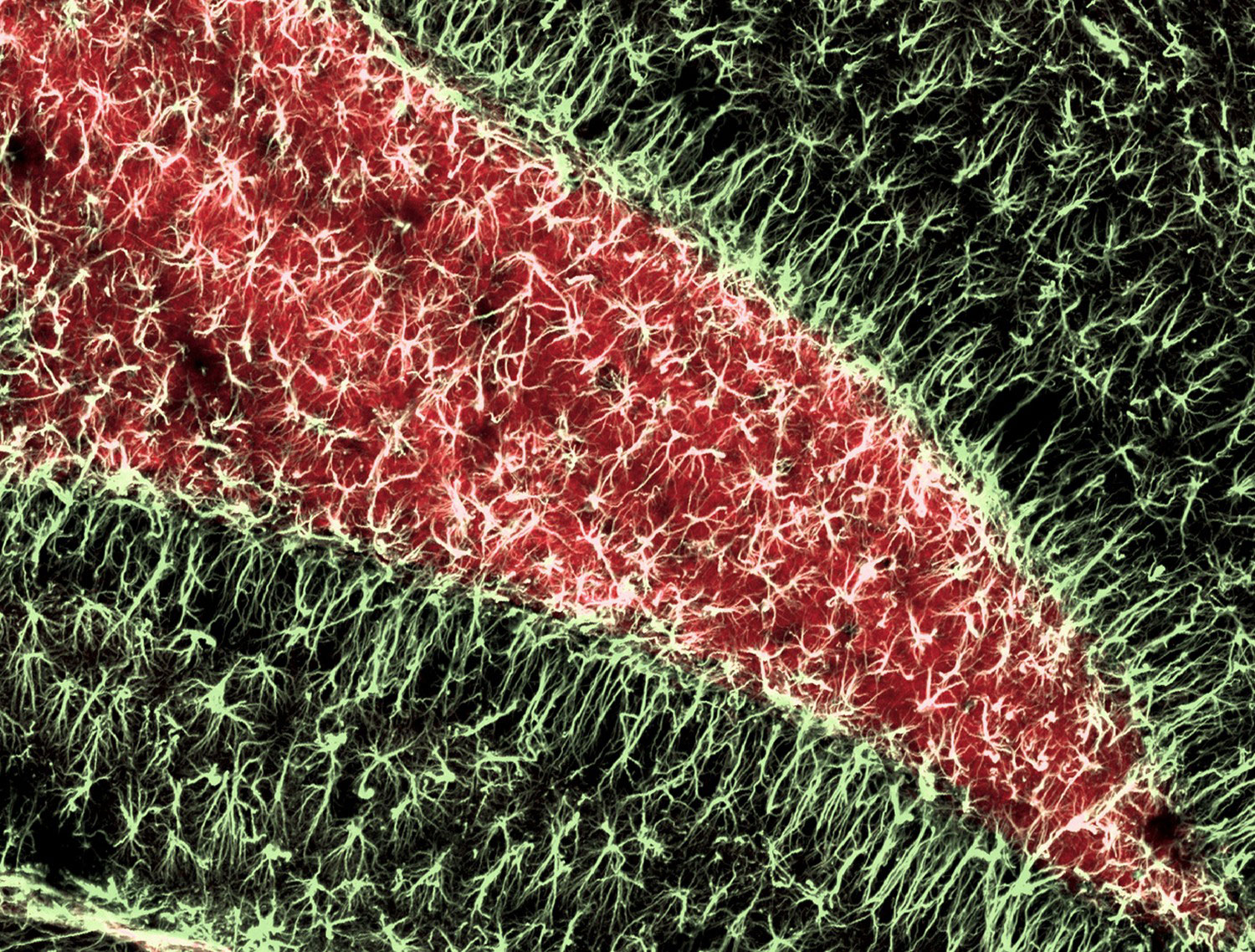 Гиппокамп взрослой мыши, фото под микроскопом