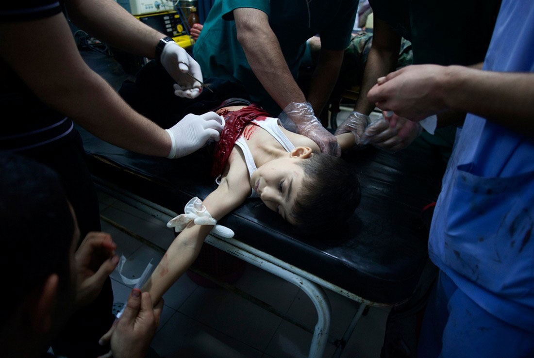 Раненый правительственными войсками мальчик, фото, Сирия