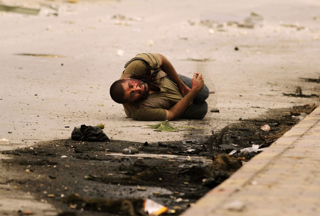 Мужчина подстреленный снайпером, фото, Сирия