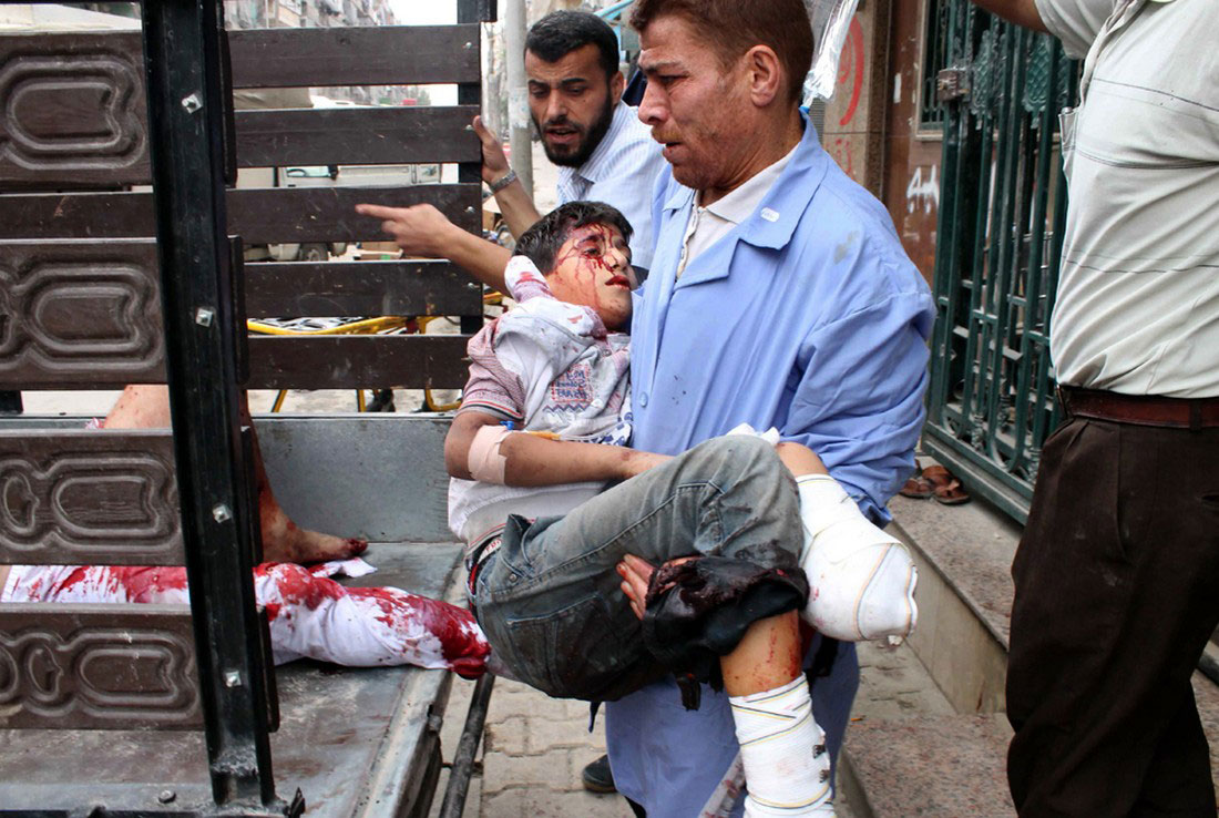 Раненый ребенок в больнице, фото, Сирия